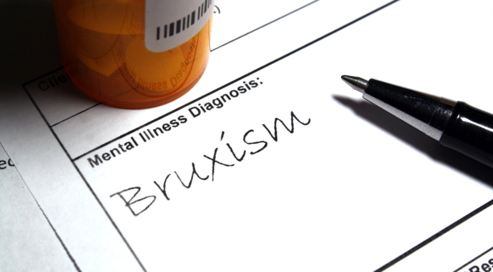 Recognizing the Warning Signs of Bruxism