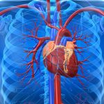 Atherosclerosis
