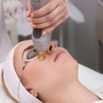 Pro Yellow Laser procedure