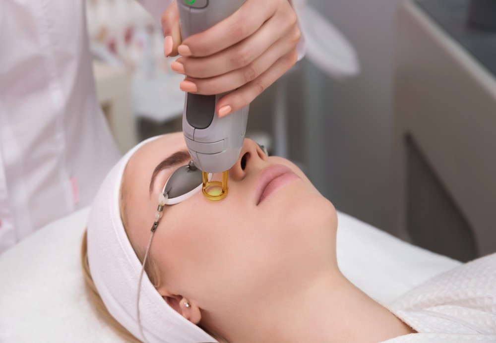 Pro Yellow Laser procedure