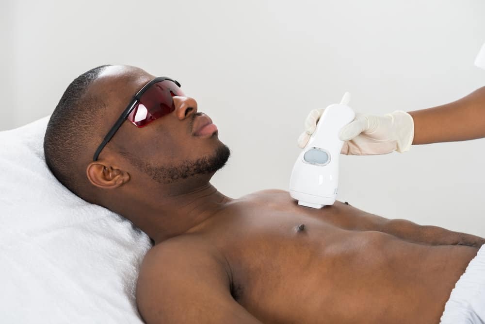 Laser Hair Removal for Dark Skin