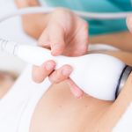 The Science Behind CoolSculpting How It Works