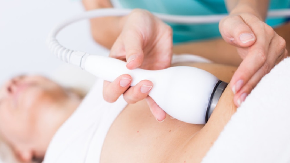 The Science Behind CoolSculpting How It Works