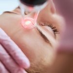 Pigmentation treatment in Singapore