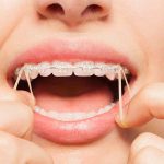 dentist in Sacramento, CA