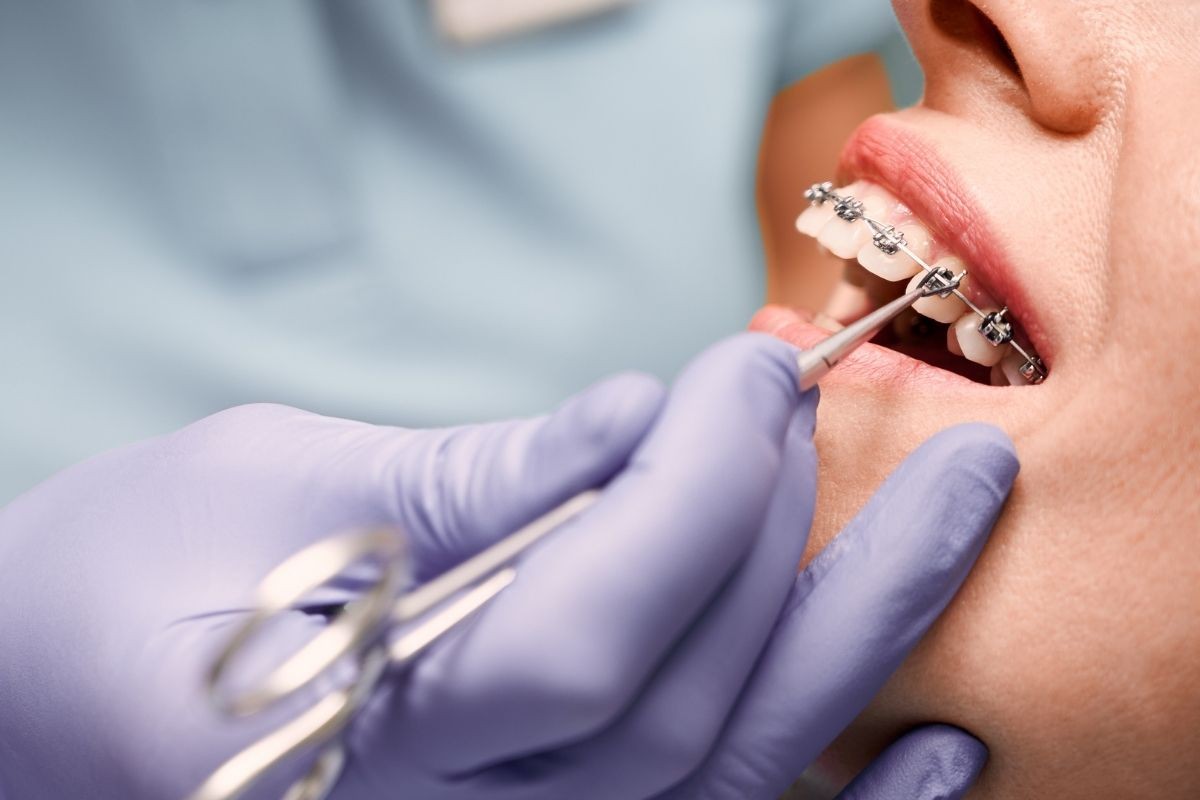 How Orthodontic Treatments Can Prevent Future Dental Issues
